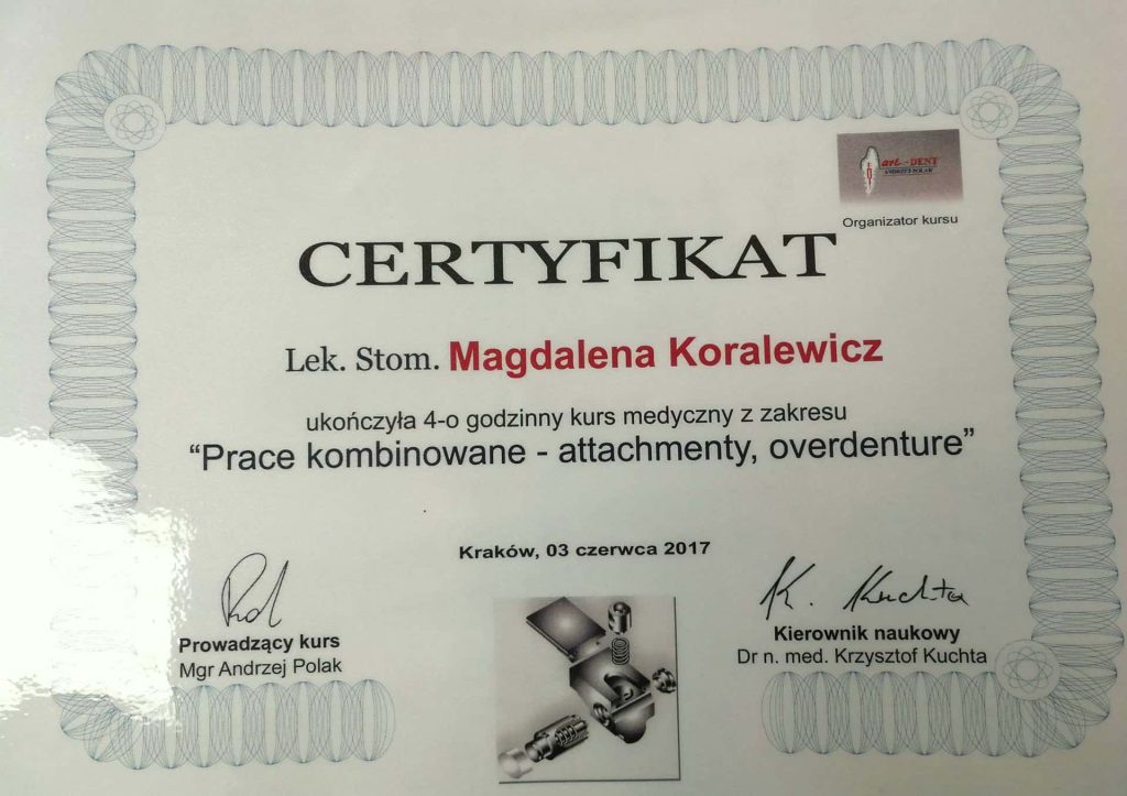 prace kombinowane, attechmenty, oervdenture lek. dent. Magdalena Koralewicz Lekarz dentysta, ekspert chirurgii i periodontologii | Numer PWZ: 2954935