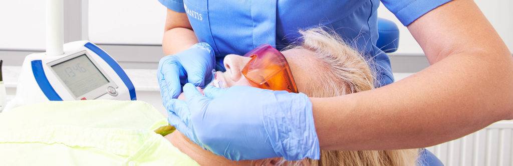 Wybielanie zębów | Dentysta Kraków, gabinet Implantis