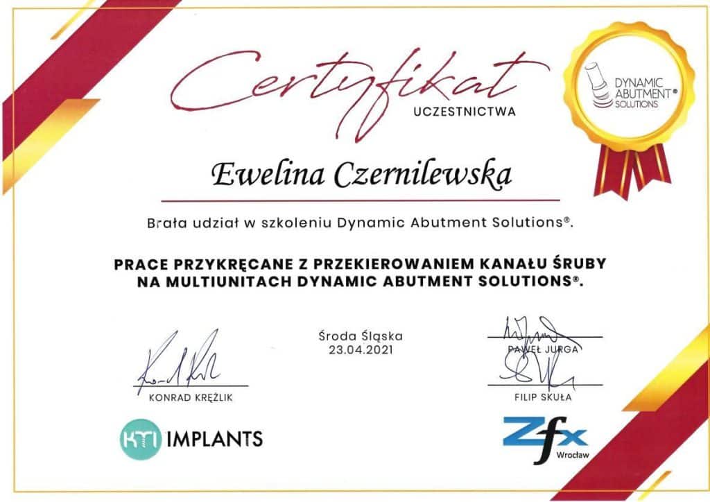 Bonding zębów kraków Ewelina Czernilewska