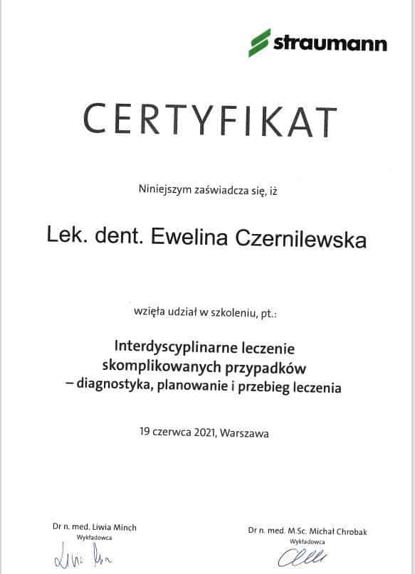 Bonding zębów kraków Ewelina Czernilewska