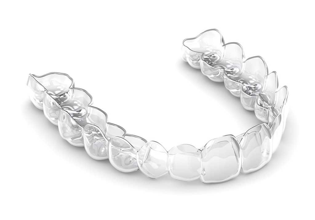 aligner Invisalign, aparat invisalign, leczenie invisalign, system invisalign