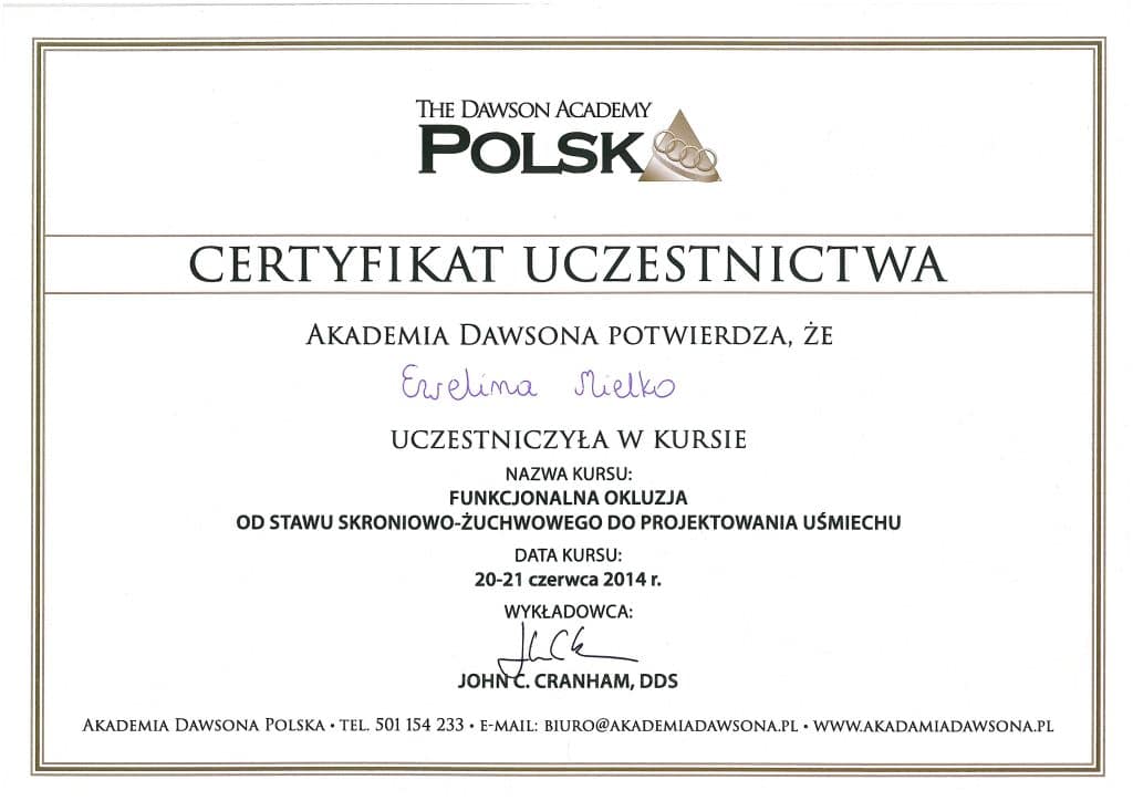Bonding zębów kraków Ewelina Czernilewska