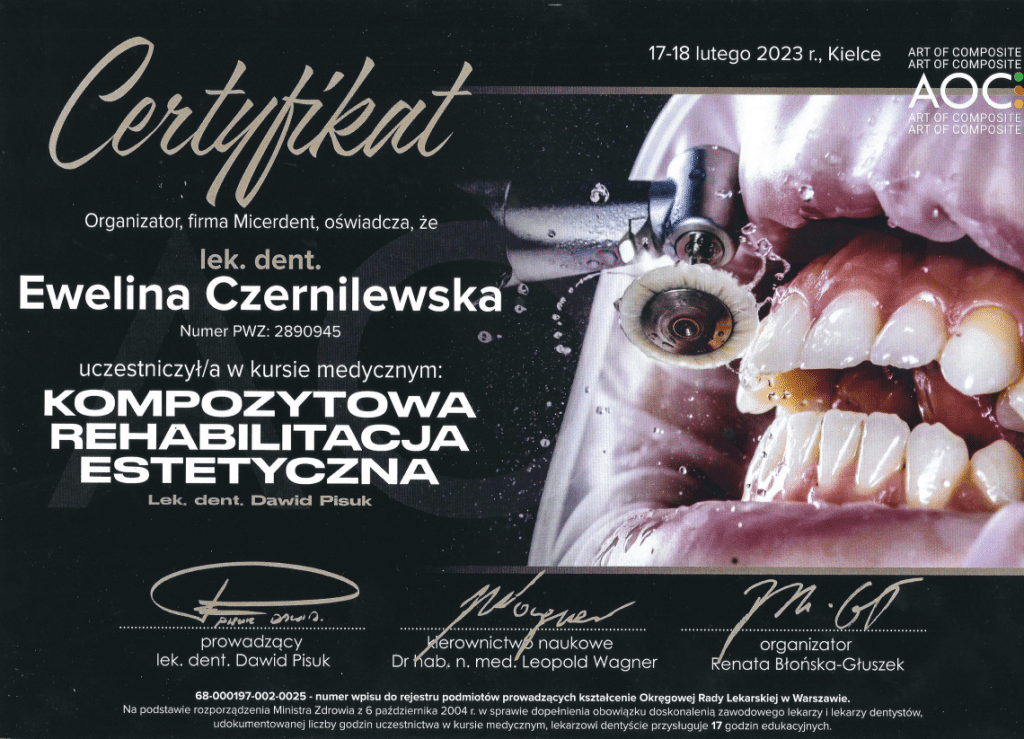 Bonding zębów, lek. stom. Ewelina Czernilewska Lekarz stomatolog, ekspert stomatologii estetycznej | Numer PWZ: 2890945