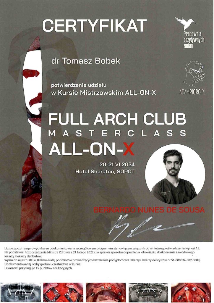 Full Arch Club, AO6, AO4, All ON 4, Tomasz Bobek
