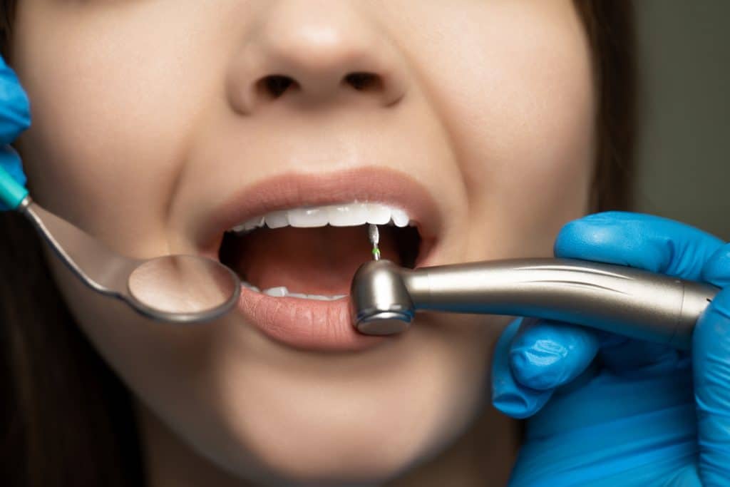 leczenie kanałowe zębów implantis kraków