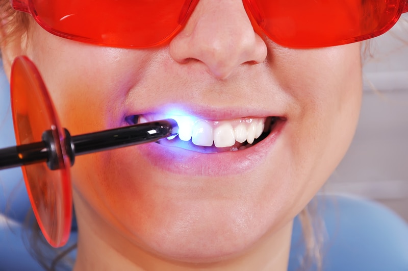 rodzaje wypełnień dentystycznych